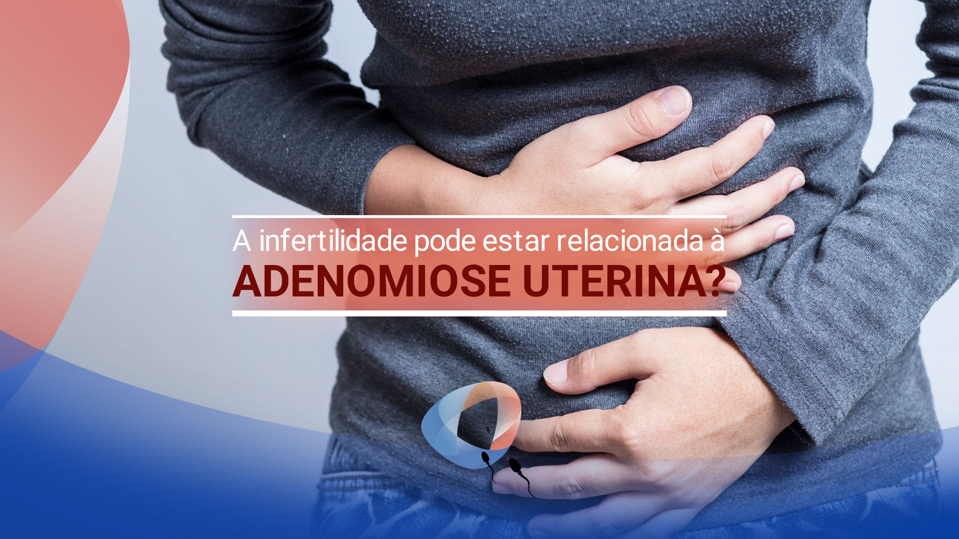 A infertilidade pode estar relacionada à adenomiose uterina?