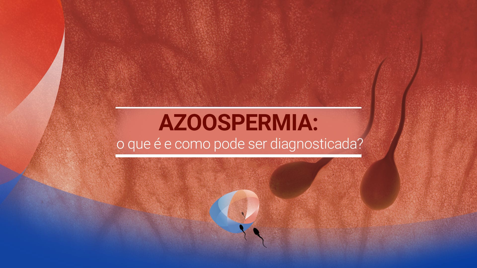 Azoospermia: o que é e como pode ser diagnosticada?