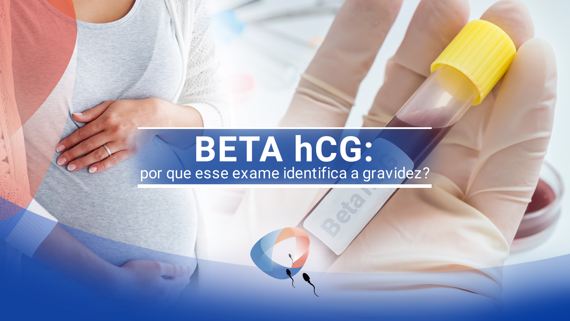 Dúvida Beta Hcg