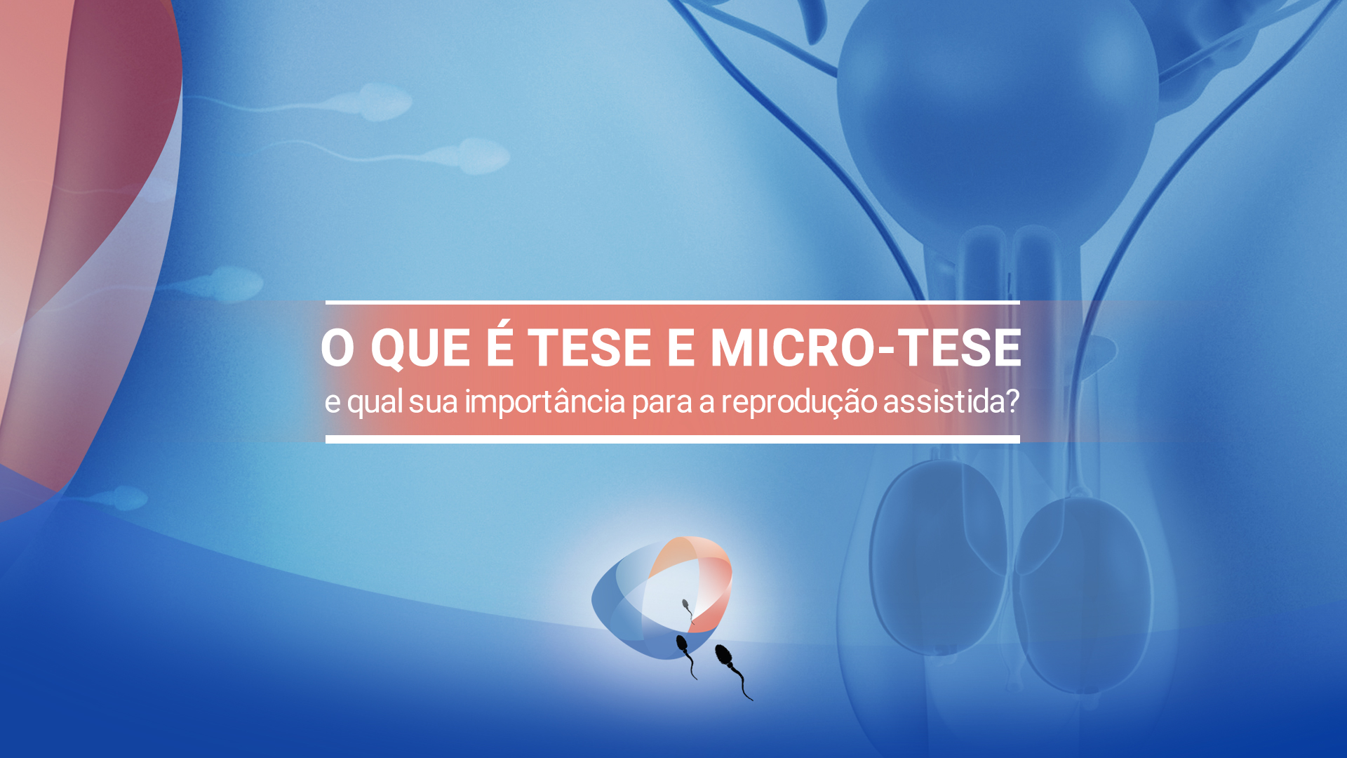 O que é TESE e Micro-TESE e qual sua importância para a reprodução assistida?