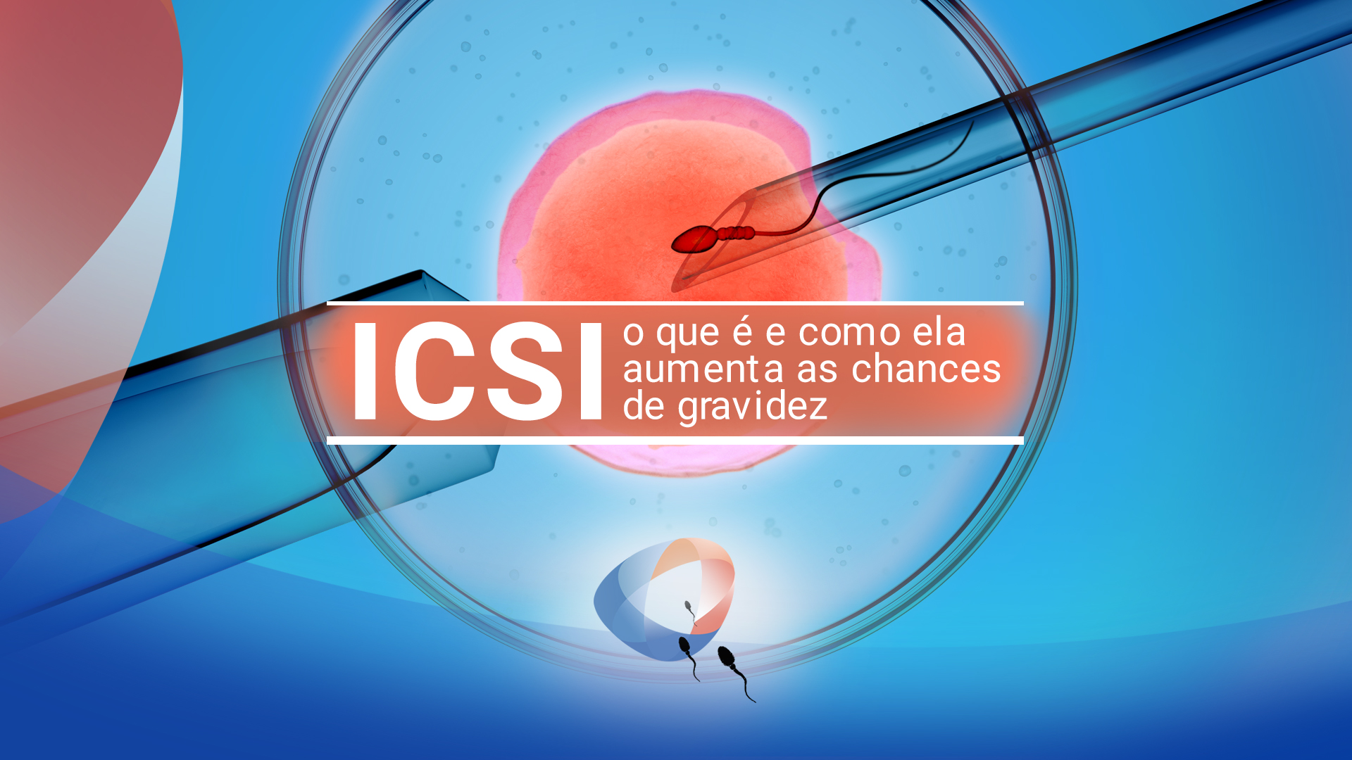 ICSI: o que é e como ela aumenta as chances de gravidez