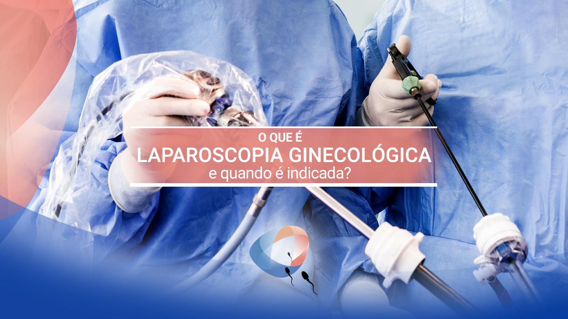 O que é laparoscopia ginecológica e quando é indicada?