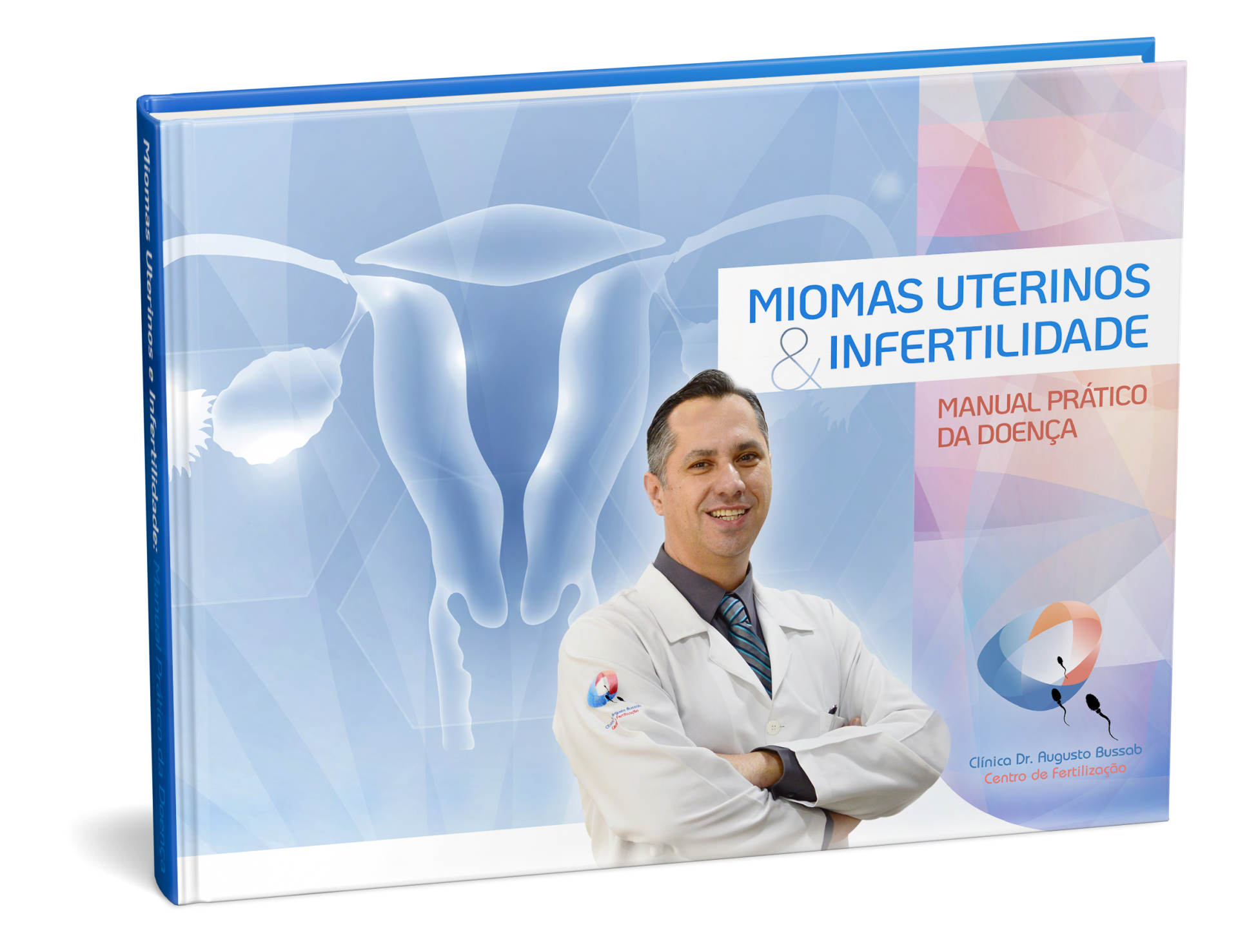 E-book | Miomas Uterinos e Infertilidade | Dr. Augusto Bussab
