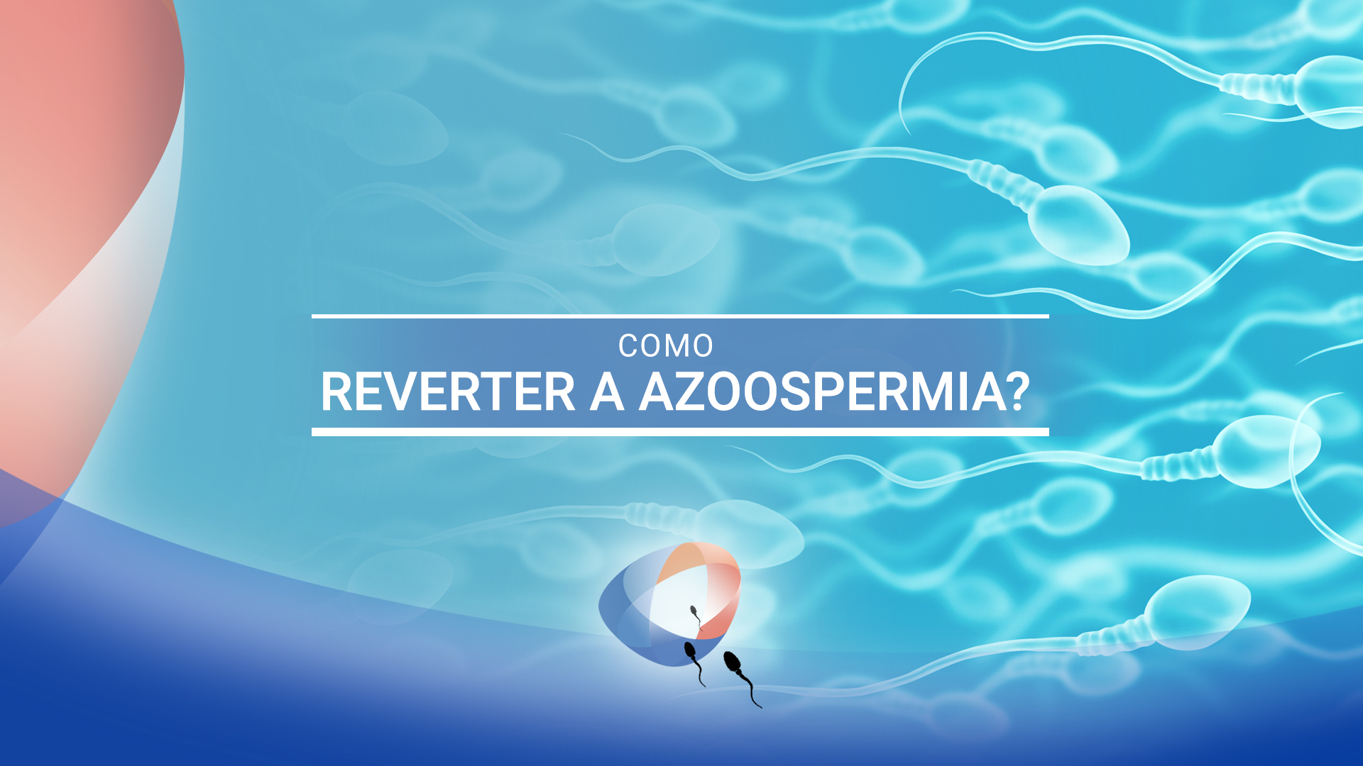 Como reverter a azoospermia?