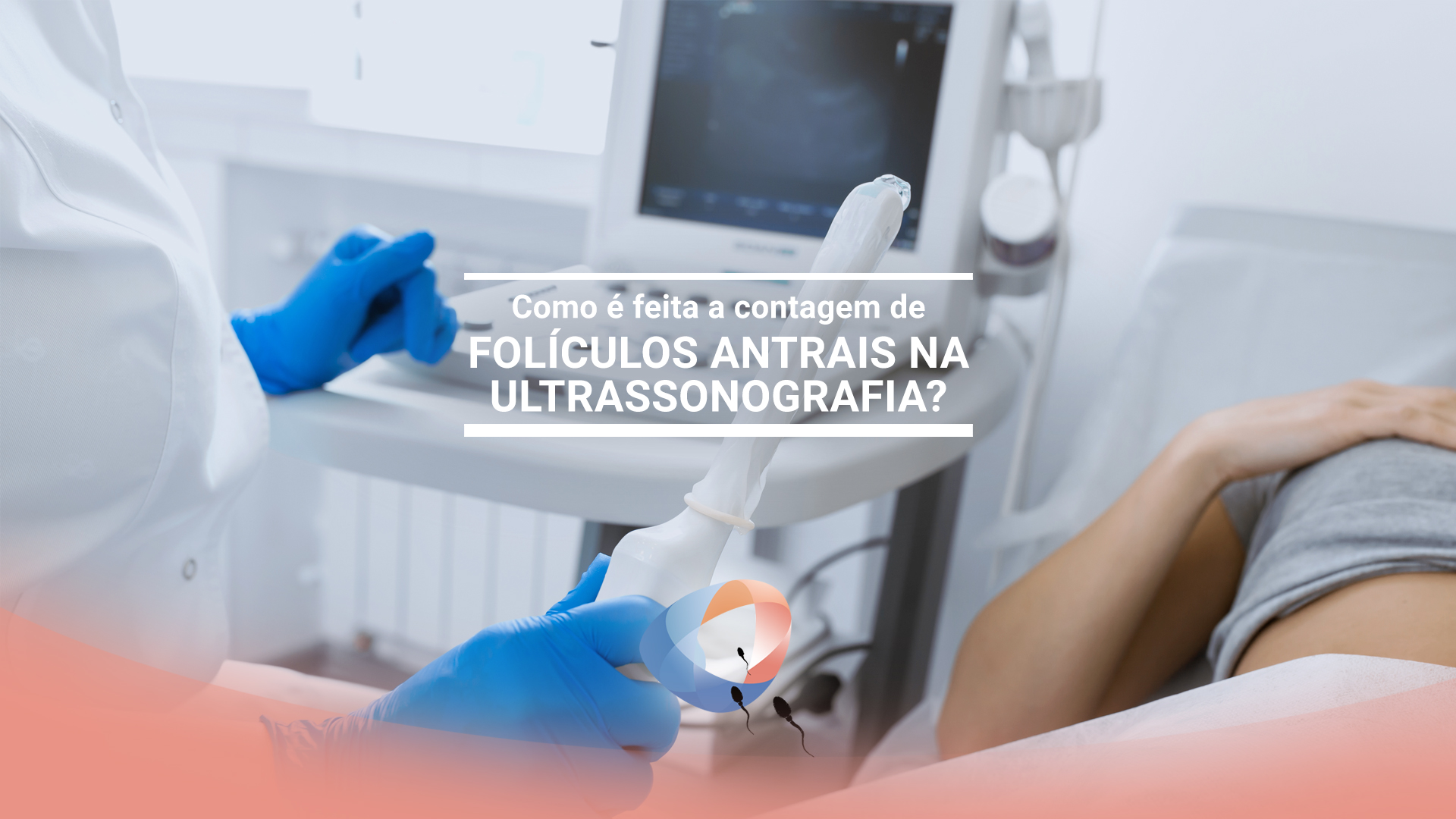 Como é feita a contagem de folículos antrais na ultrassonografia?