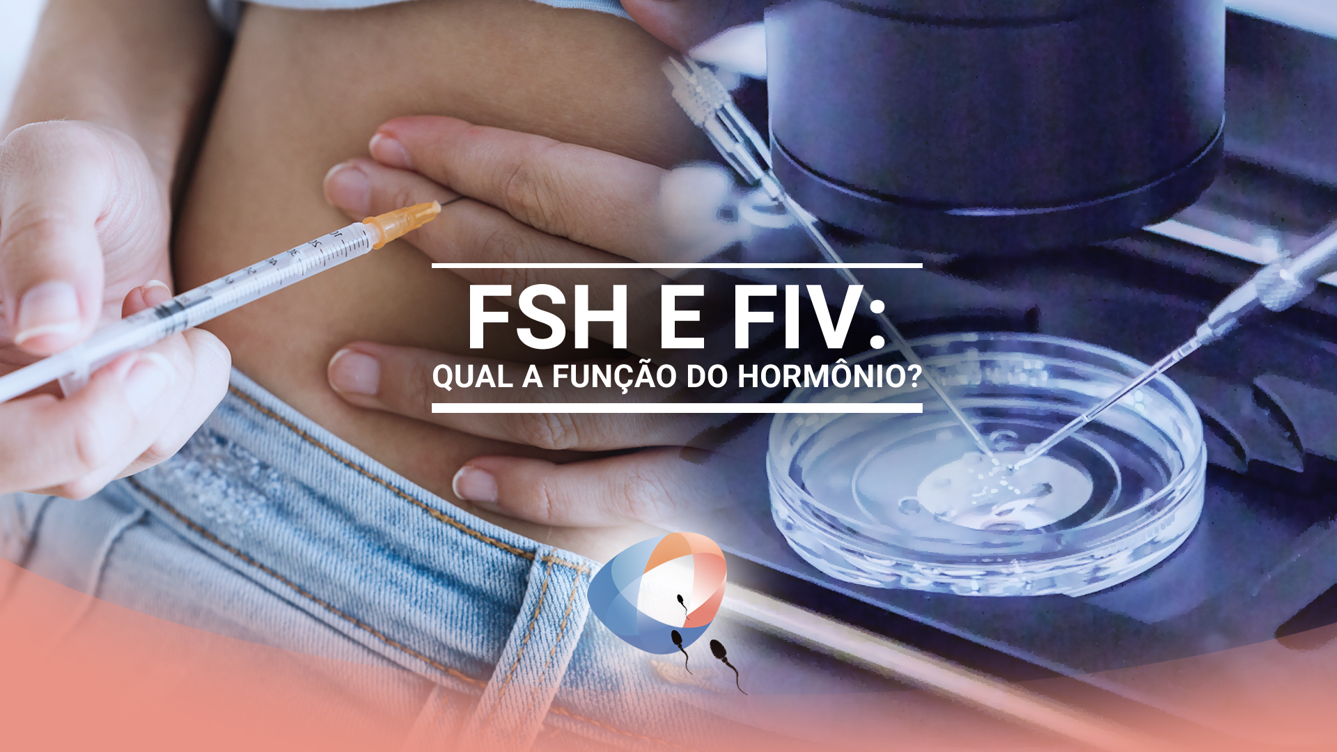 FSH e FIV: qual a função do hormônio?