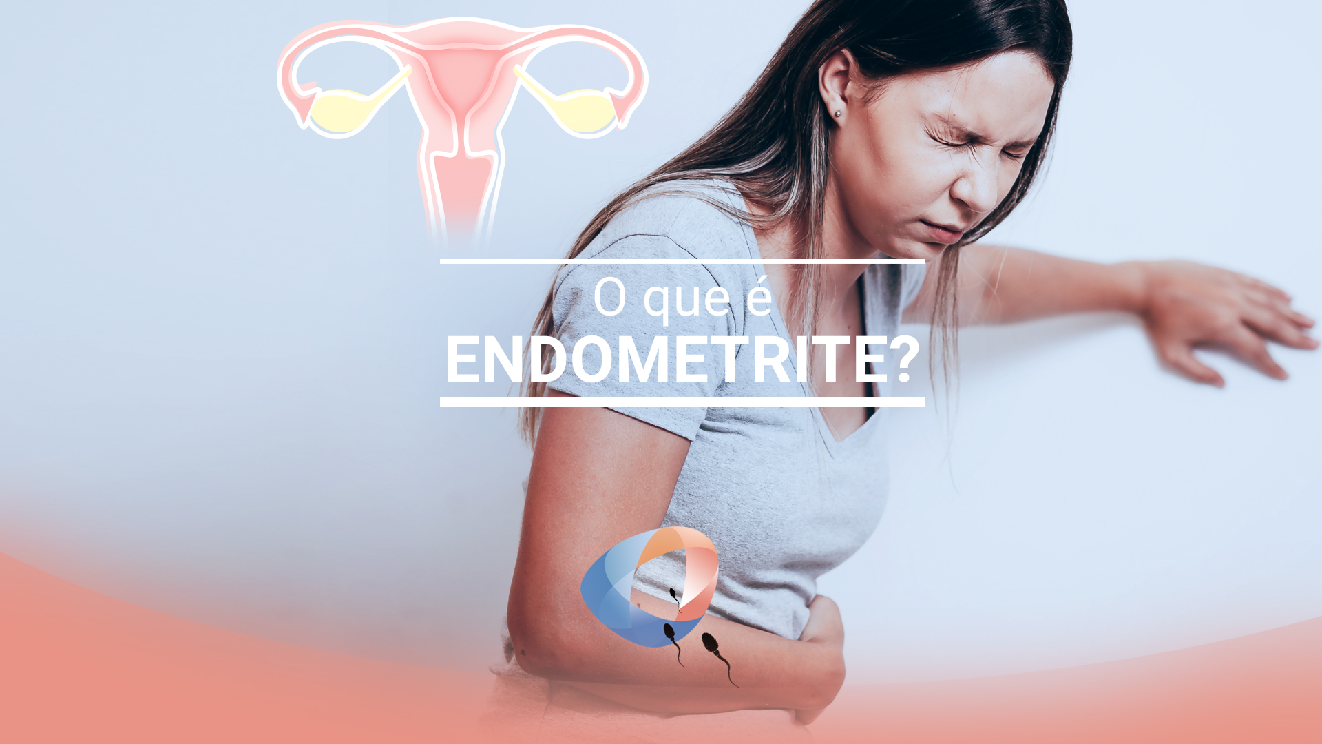 O que é endometrite?