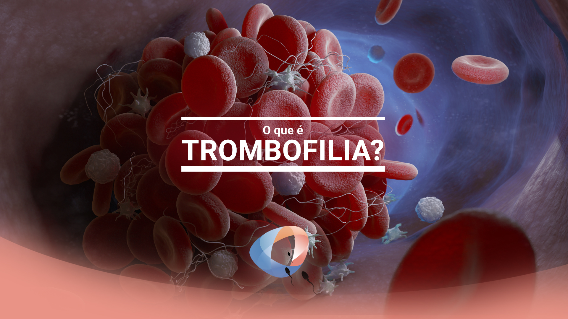 O que é trombofilia?