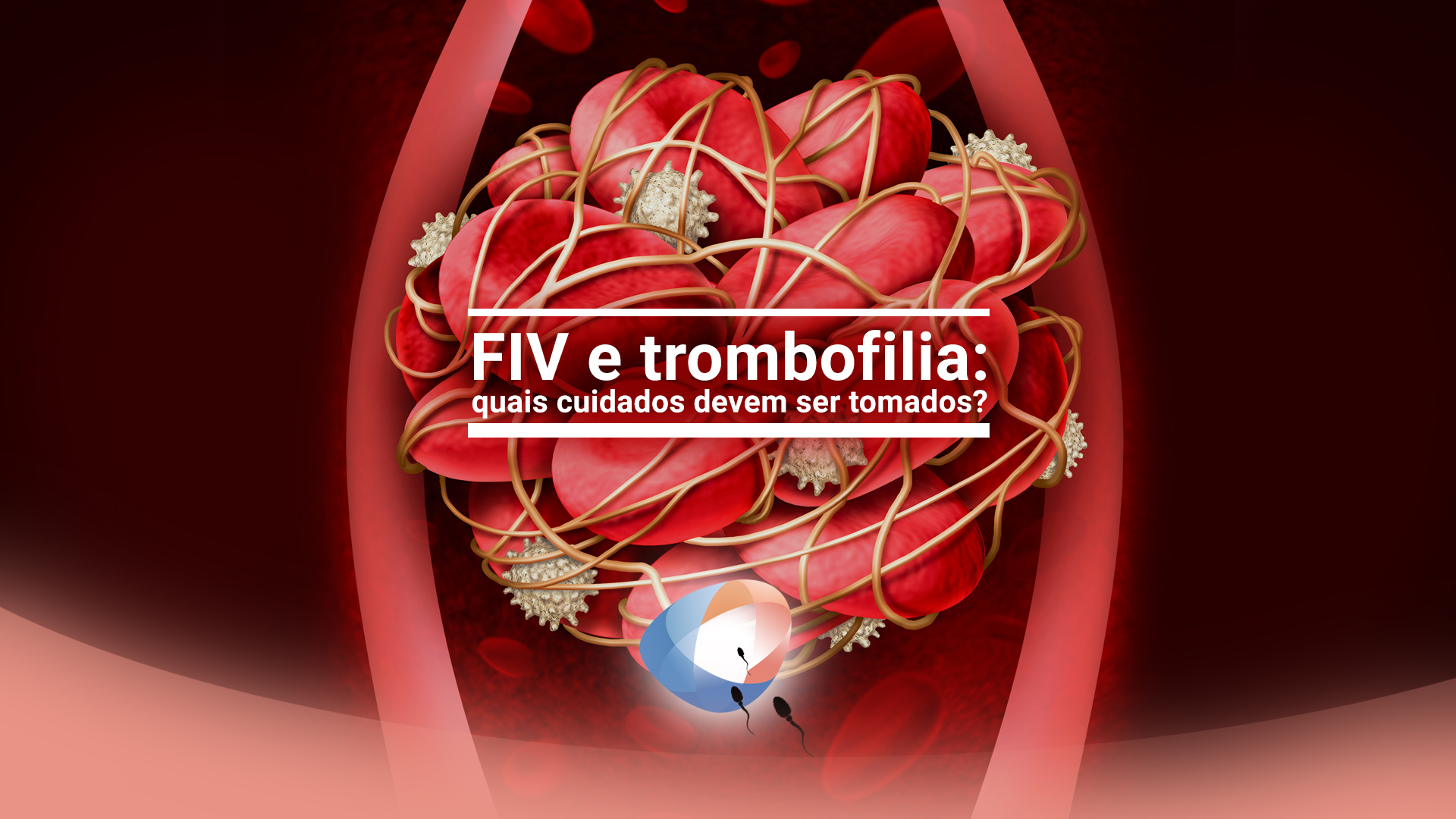 FIV e trombofilia: quais cuidados devem ser tomados?