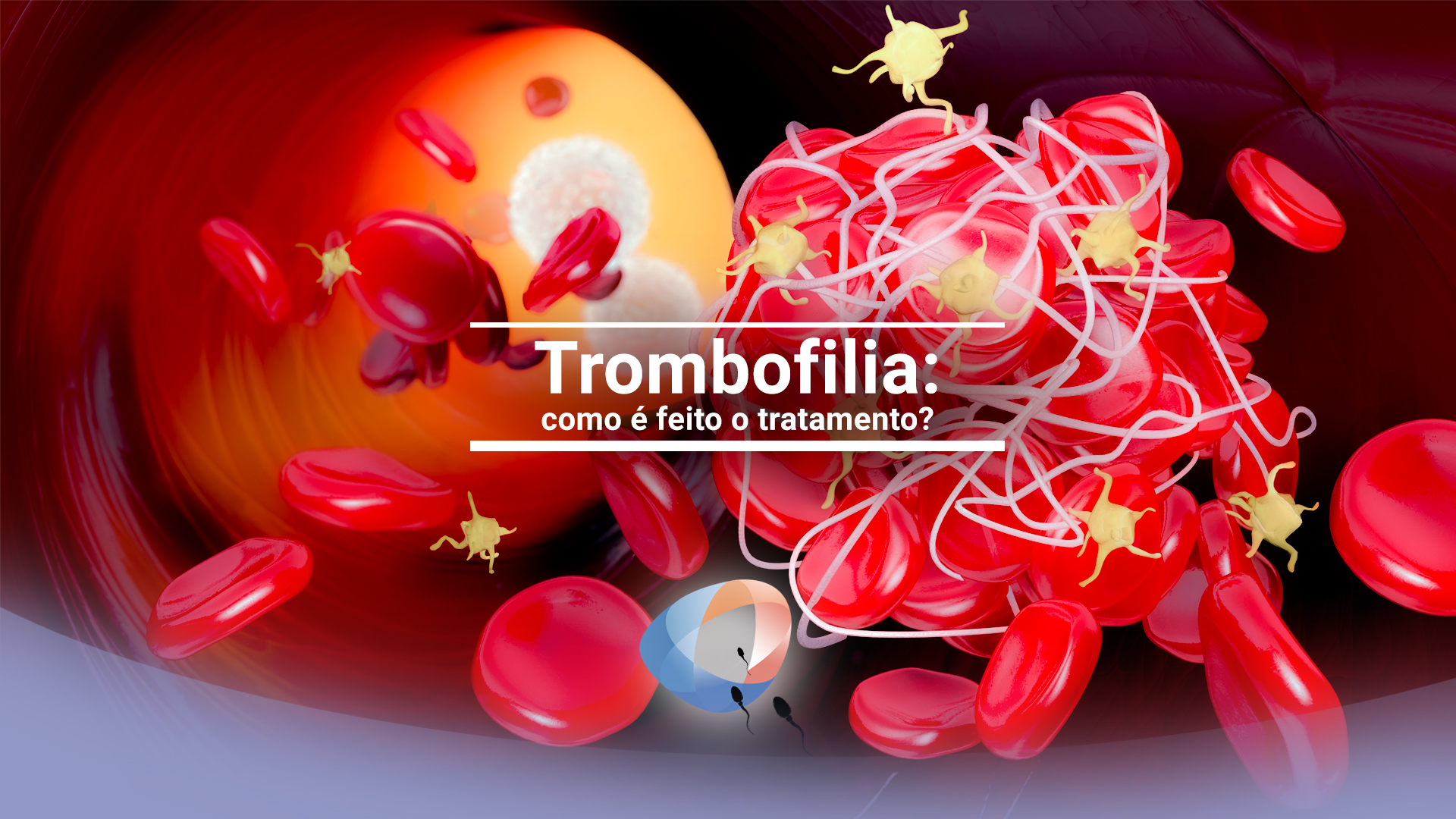 Trombofilia: como é feito o tratamento?