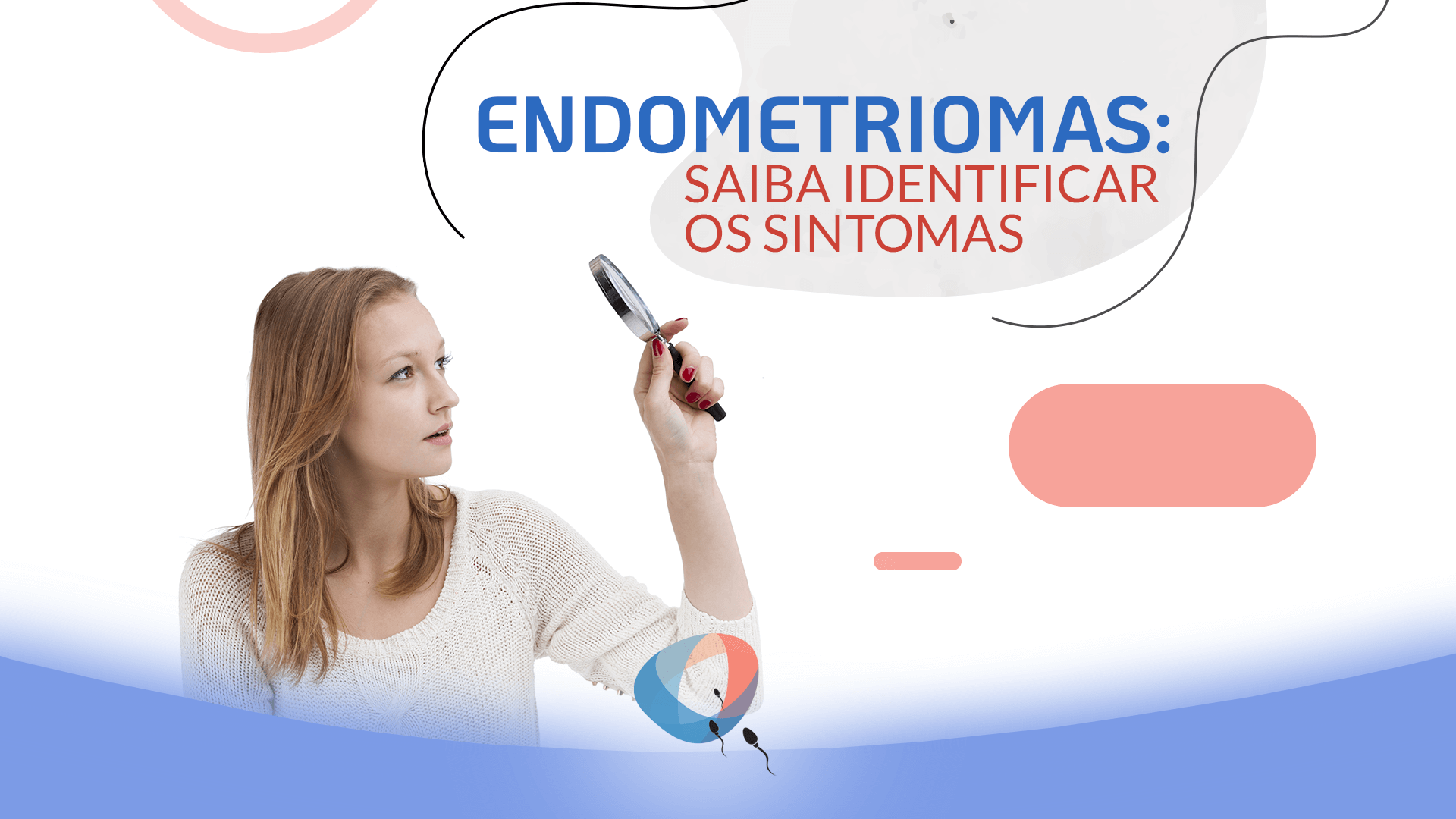 Endometriomas: saiba identificar os sintomas
