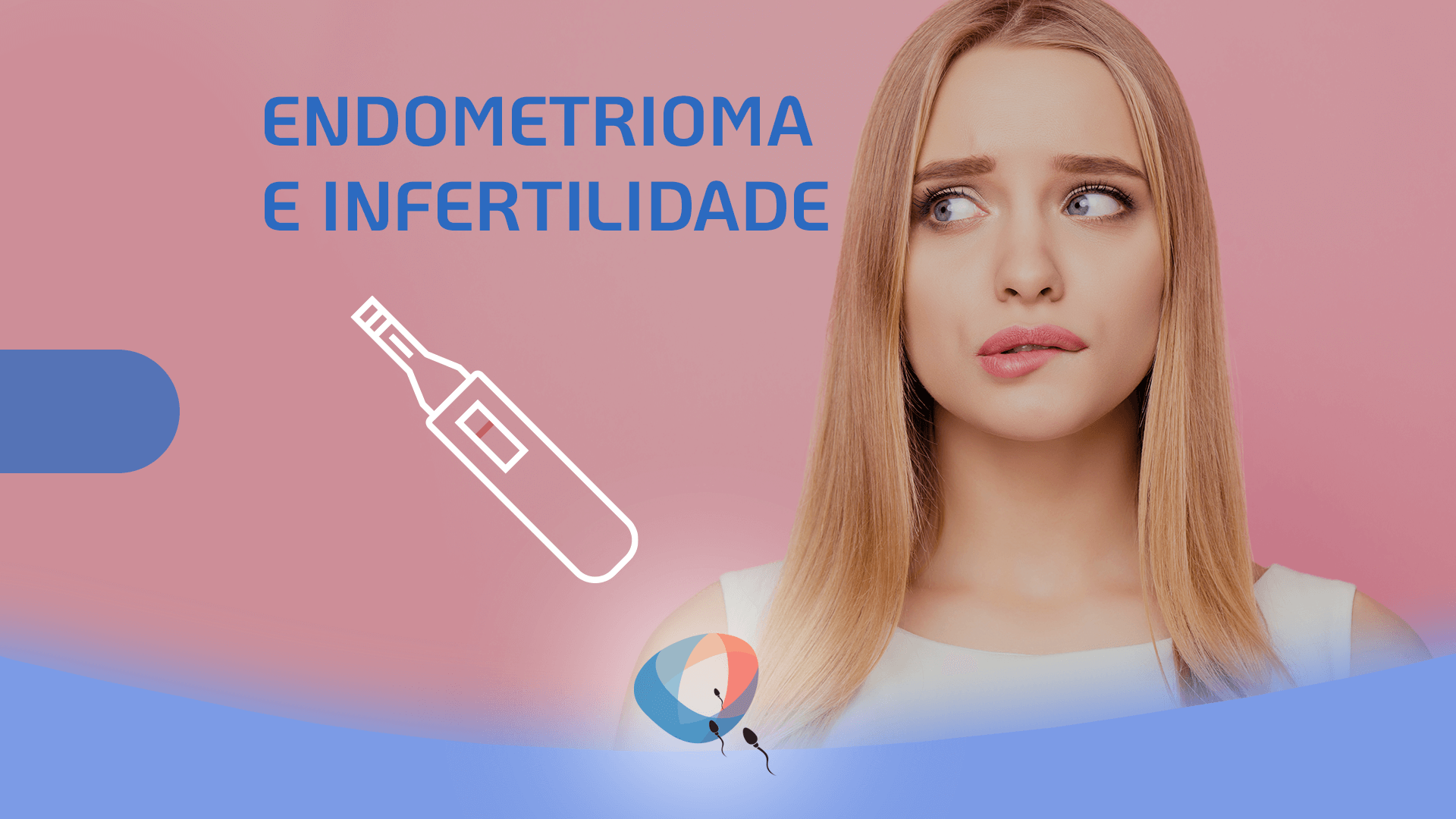 Endometrioma E Infertilidade Dr Augusto Bussab Reprodução Humana 8646