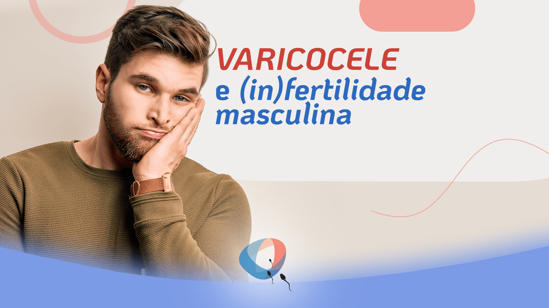 Varicocele e (in)fertilidade masculina