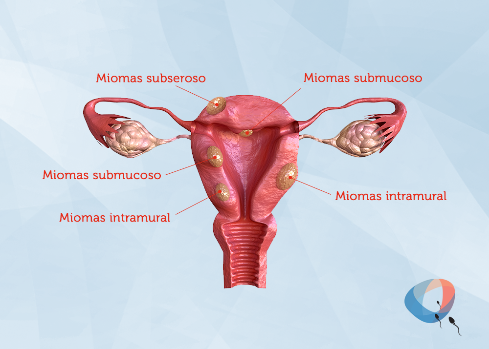 O que é receptividade endometrial e qual sua relação com a fertilidade?, Dr. Augusto Bussab