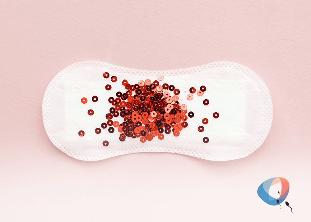 Ausência de menstruação (amenorreia) pode ser sinal de infertilidade?