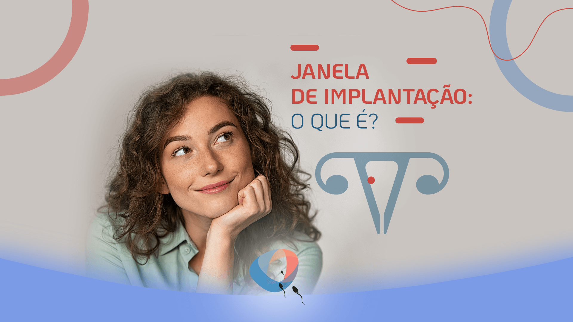 Janela de implantação: o que é