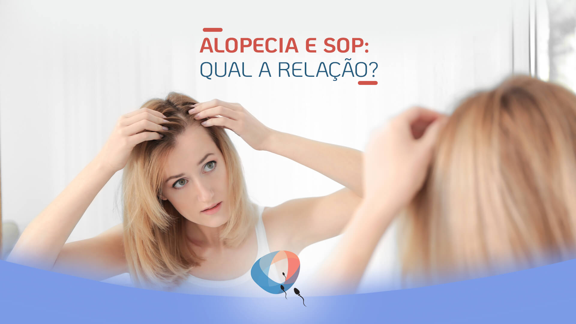 Alopecia e SOP: qual a relação?