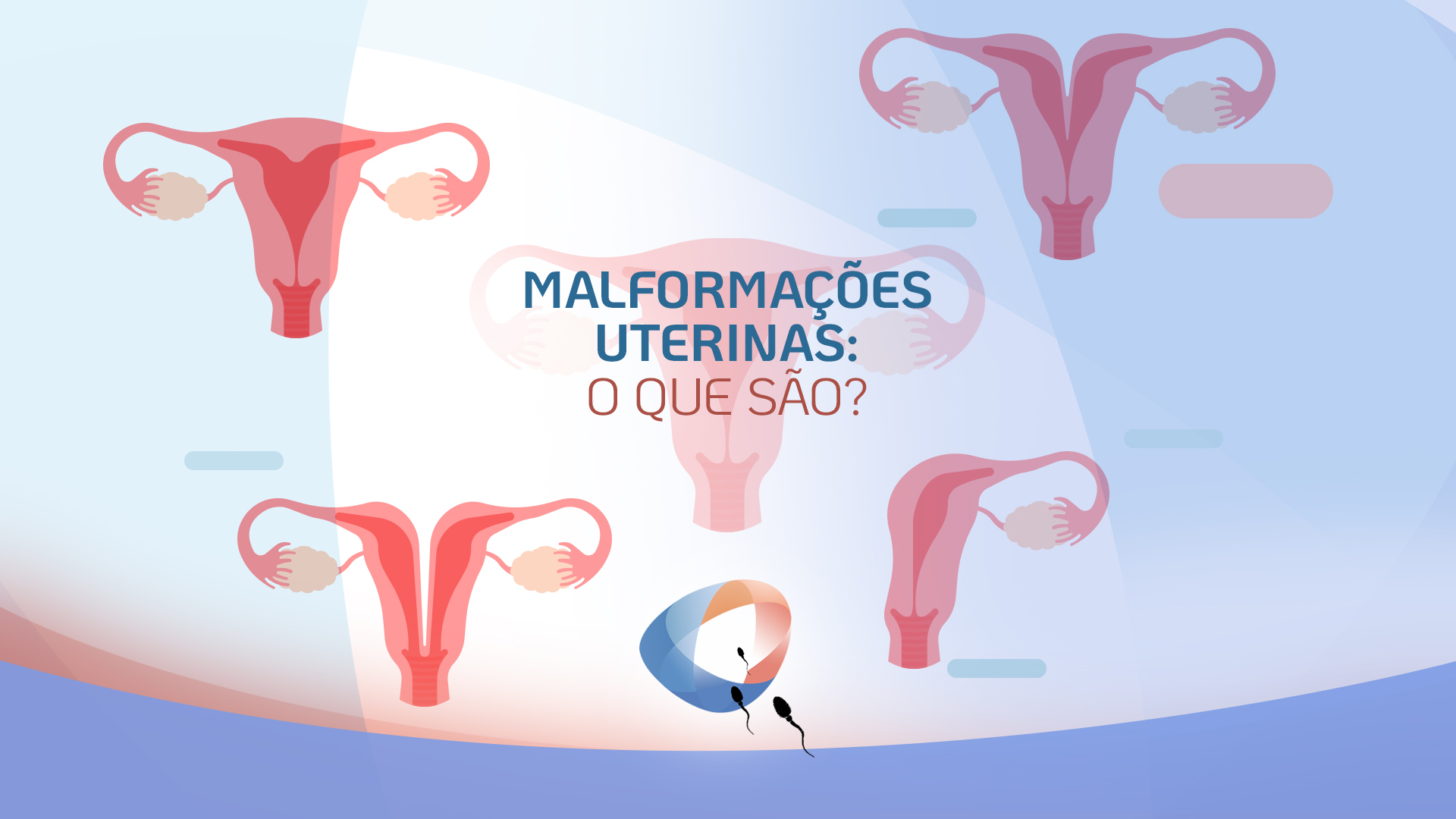 Malformações uterinas o que são Dr Augusto Bussab Reprodução Humana