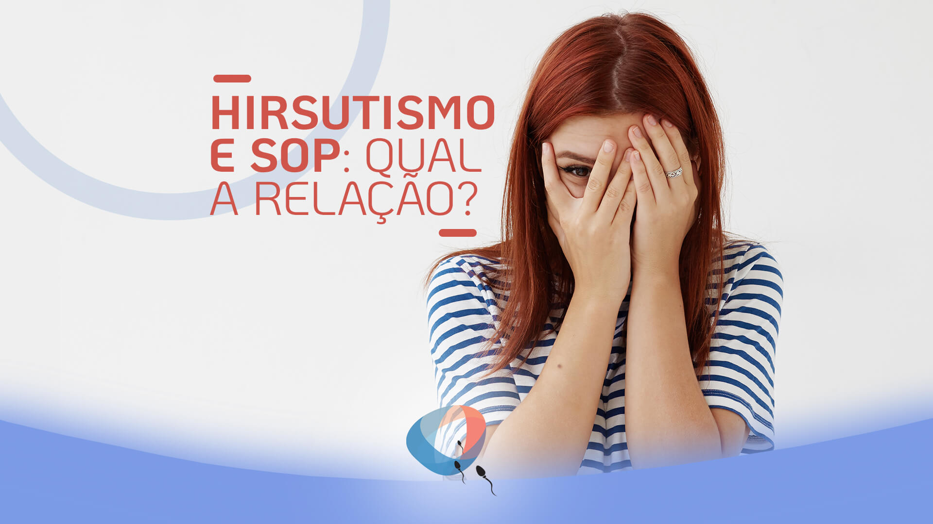 Hirsutismo e SOP: qual a relação?