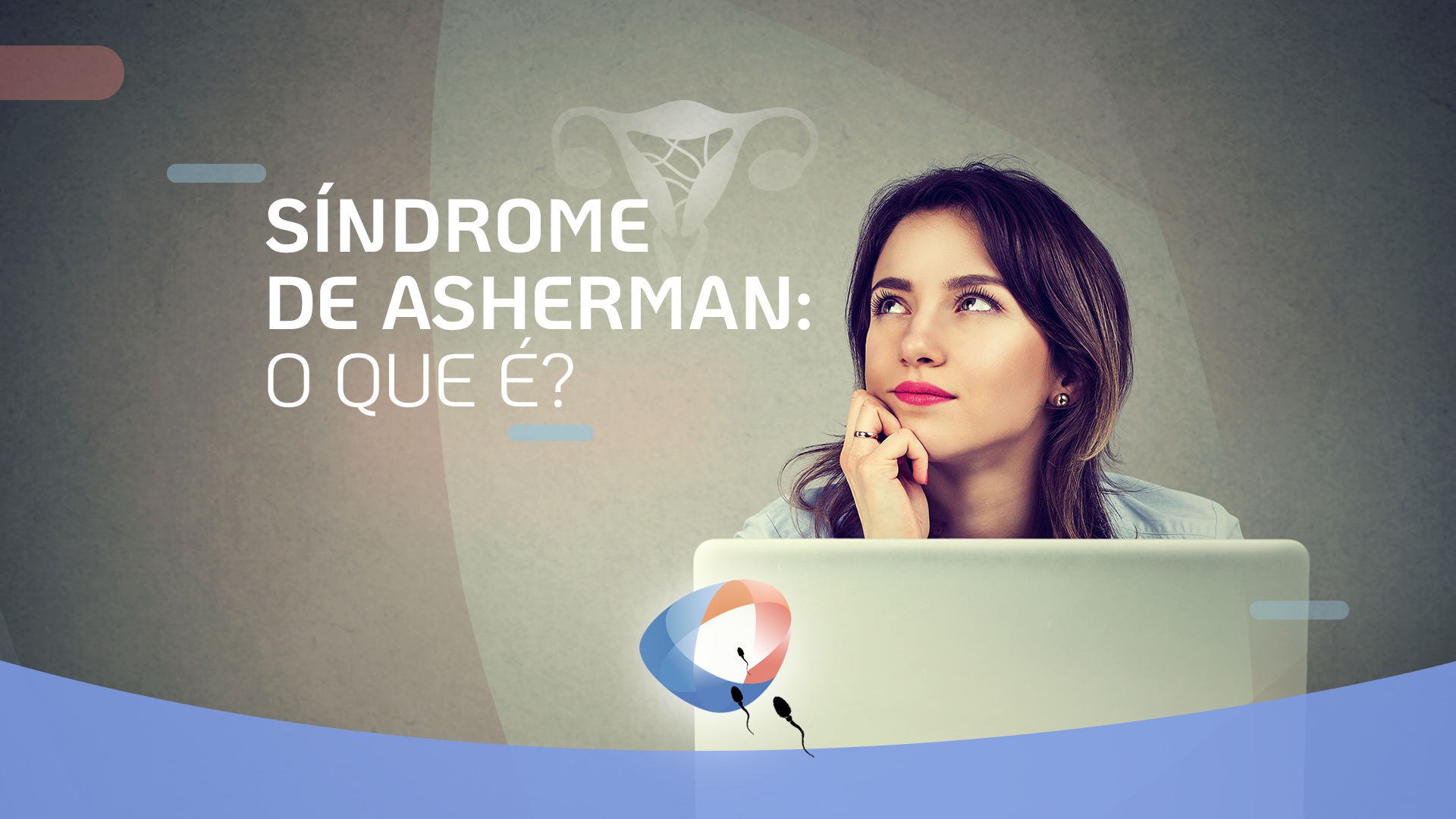 Síndrome de Asherman: o que é?