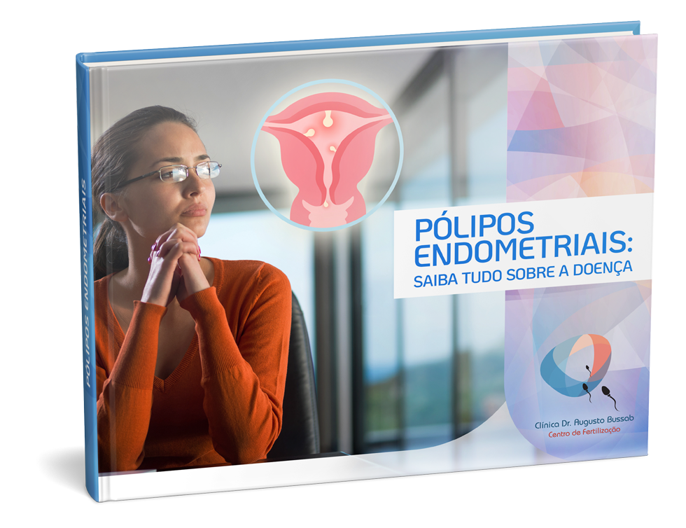 E-book |Pólipos endometriais: saiba tudo sobre a doença | Dr. Augusto Bussab