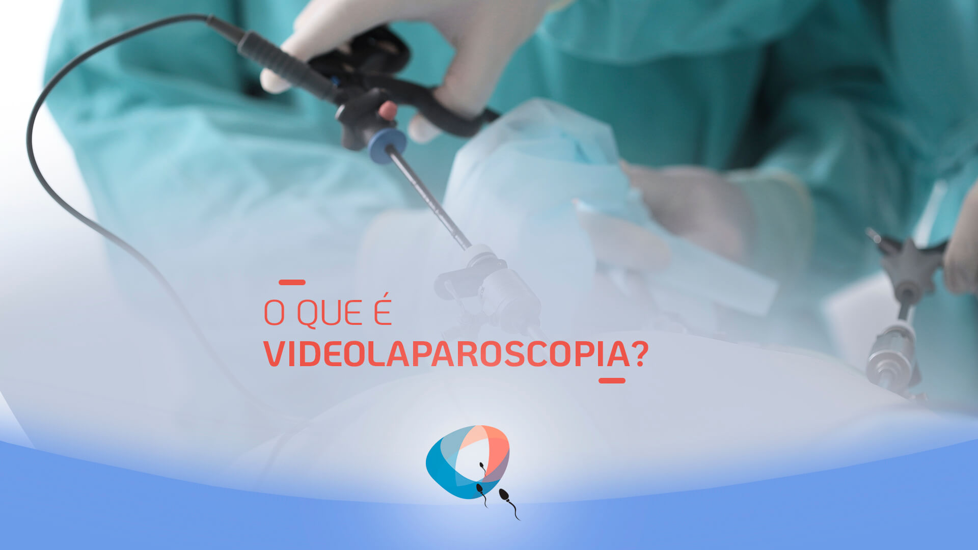 O que é videolaparoscopia?