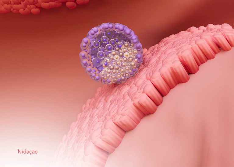 Nidação ou menstruação como diferenciar o sangramento Dr Augusto